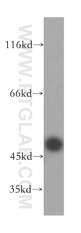 Western Blot (WB) analysis of HEK-293 cells using TASP1 Polyclonal antibody (16739-1-AP)