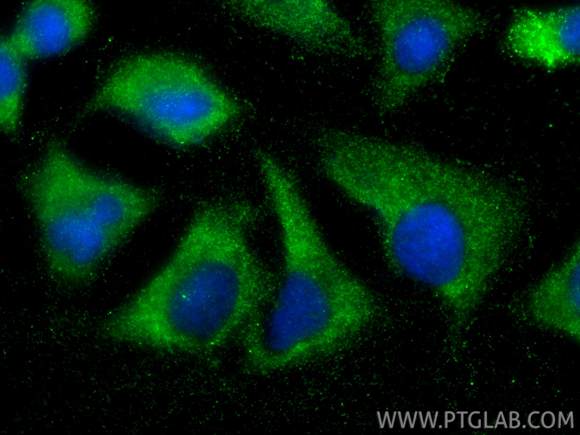 IF Staining of A549 using 33698-1-AP Immunofluorescence (IF) / fluorescent staining of A549 cells using TAT Polyclonal antibody (33698-1-AP)