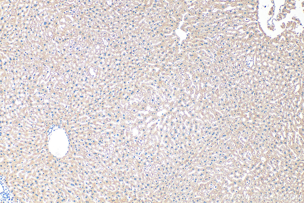 IHC staining of mouse liver using 33698-1-AP Immunohistochemistry (IHC) staining of mouse liver tissue using TAT Polyclonal antibody (33698-1-AP)