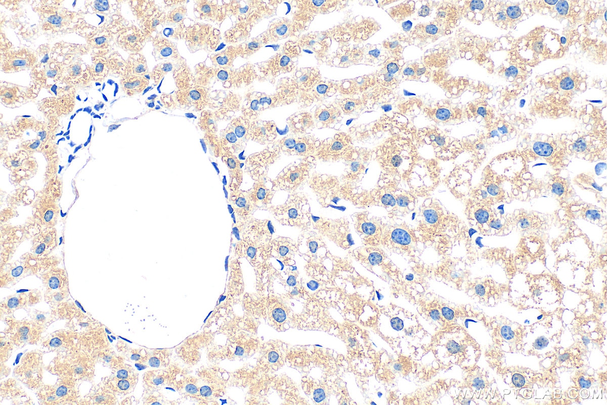 IHC staining of mouse liver using 33698-1-AP Immunohistochemistry (IHC) staining of mouse liver tissue using TAT Polyclonal antibody (33698-1-AP)
