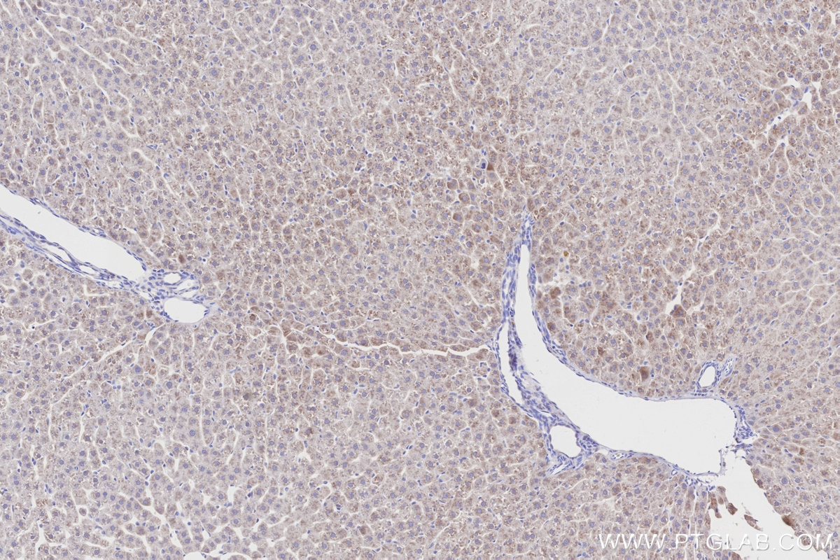 IHC staining of rat liver using 33698-1-AP Immunohistochemistry (IHC) staining of rat liver tissue using TAT Polyclonal antibody (33698-1-AP)