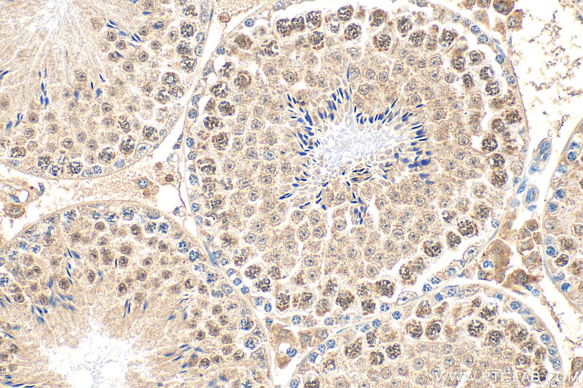 Immunohistochemistry (IHC) staining of mouse testis tissue using TATDN1 Polyclonal antibody (31840-1-AP)
