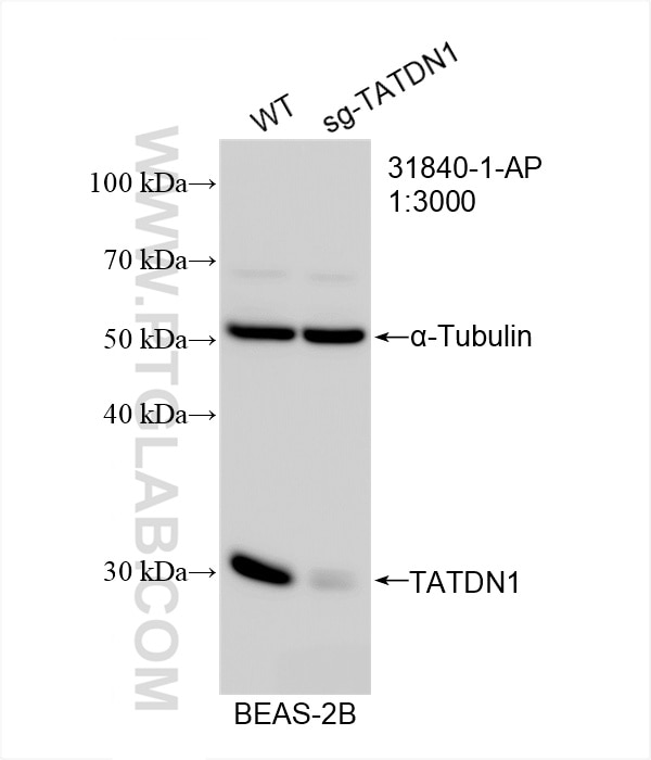 Western Blot (WB) analysis of BEAS-2B cells using TATDN1 Polyclonal antibody (31840-1-AP)