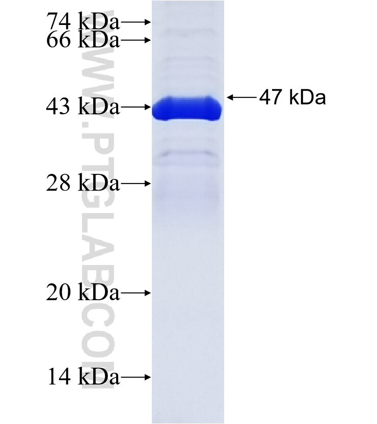 TATDN1 fusion protein Ag36040 SDS-PAGE