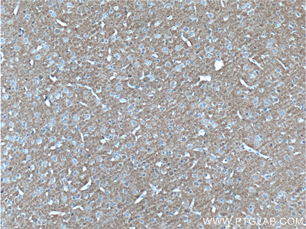 Immunohistochemistry (IHC) staining of mouse brain tissue using TAU Monoclonal antibody (66499-1-Ig)
