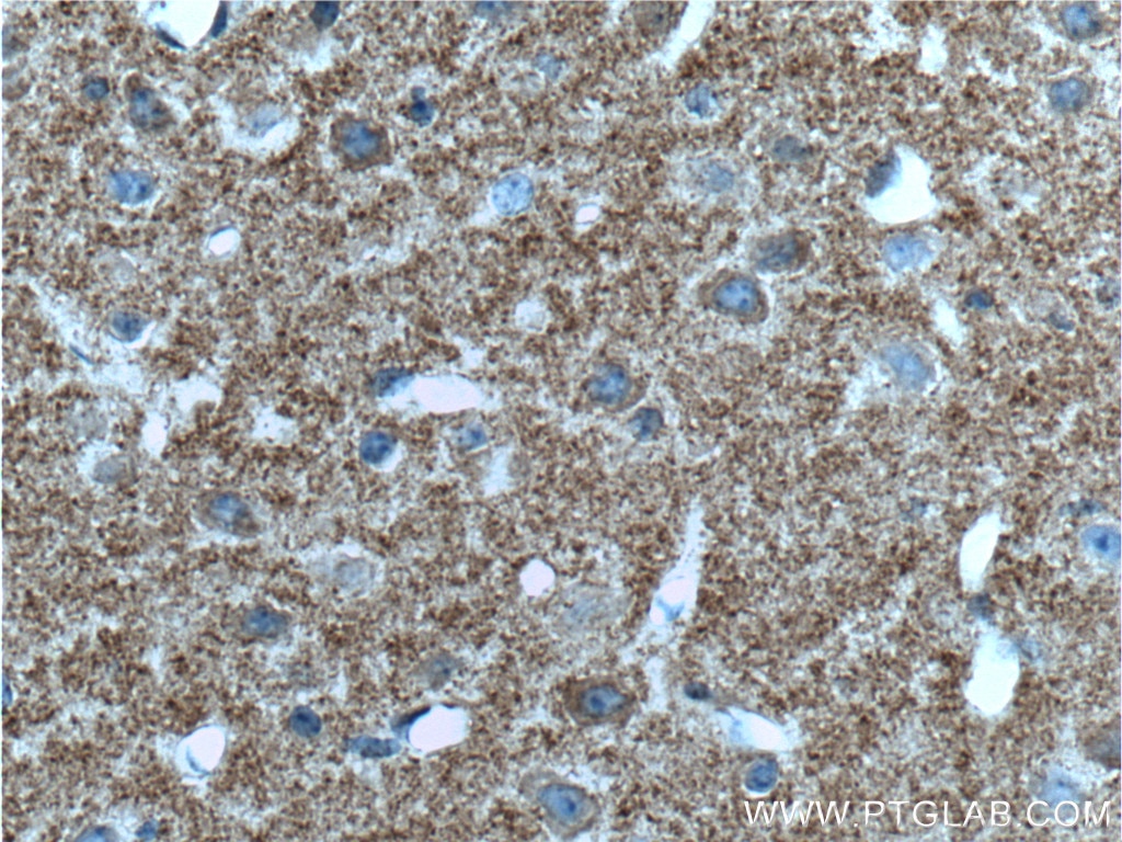 Immunohistochemistry (IHC) staining of mouse brain tissue using TAU Monoclonal antibody (66499-1-Ig)