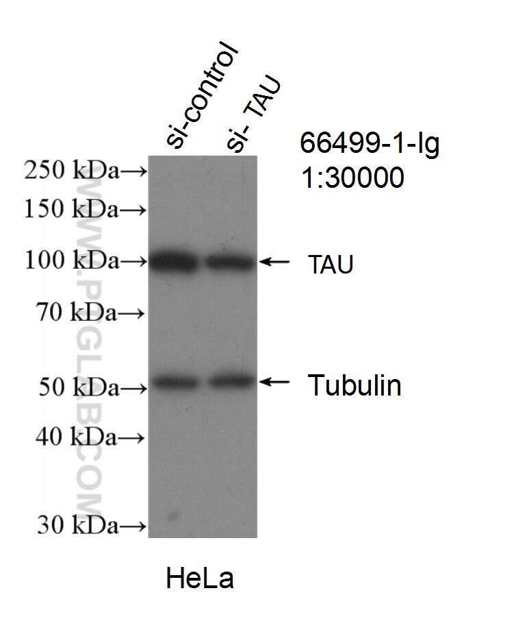 WB analysis of HeLa using 66499-1-Ig