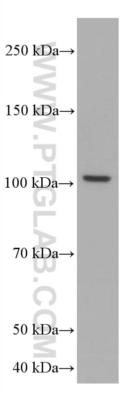 Western Blot (WB) analysis of SH-SY5Y cells using TAU Monoclonal antibody (66499-1-Ig)