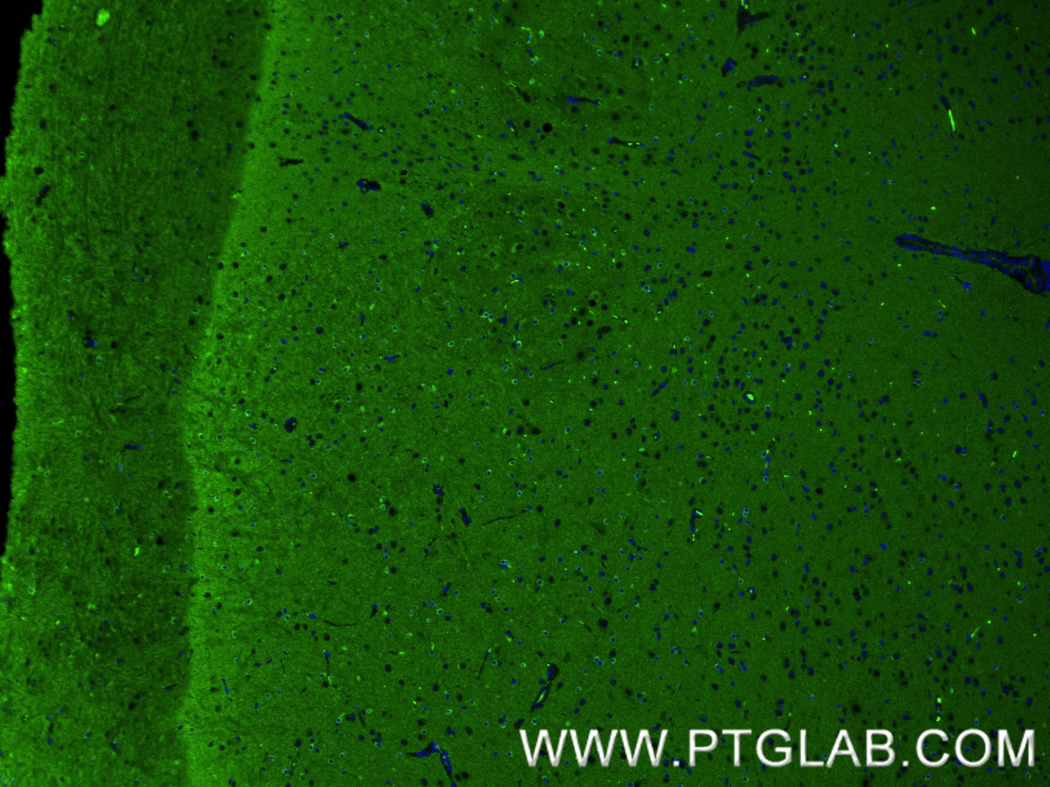 Immunofluorescence (IF) / fluorescent staining of mouse brain tissue using TAU Recombinant monoclonal antibody (82846-5-RR)
