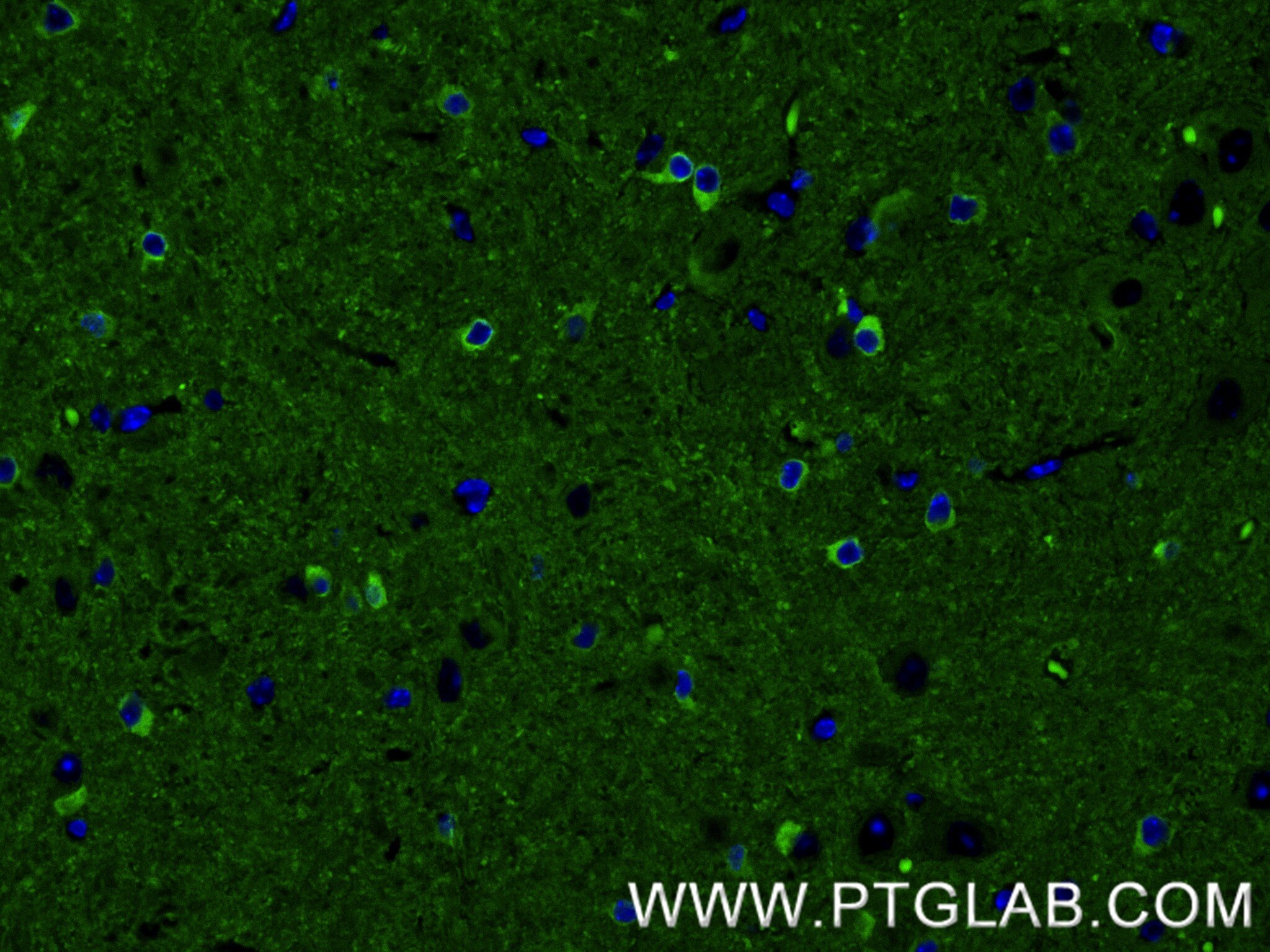 Immunofluorescence (IF) / fluorescent staining of mouse brain tissue using TAU Recombinant monoclonal antibody (82846-5-RR)