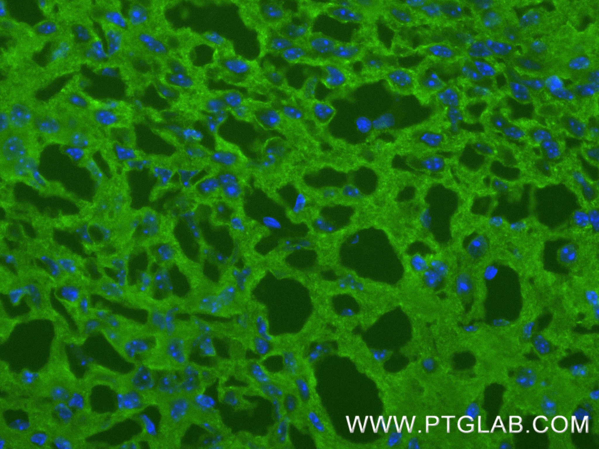 Immunofluorescence (IF) / fluorescent staining of mouse brain tissue using TAU Recombinant monoclonal antibody (82846-5-RR)