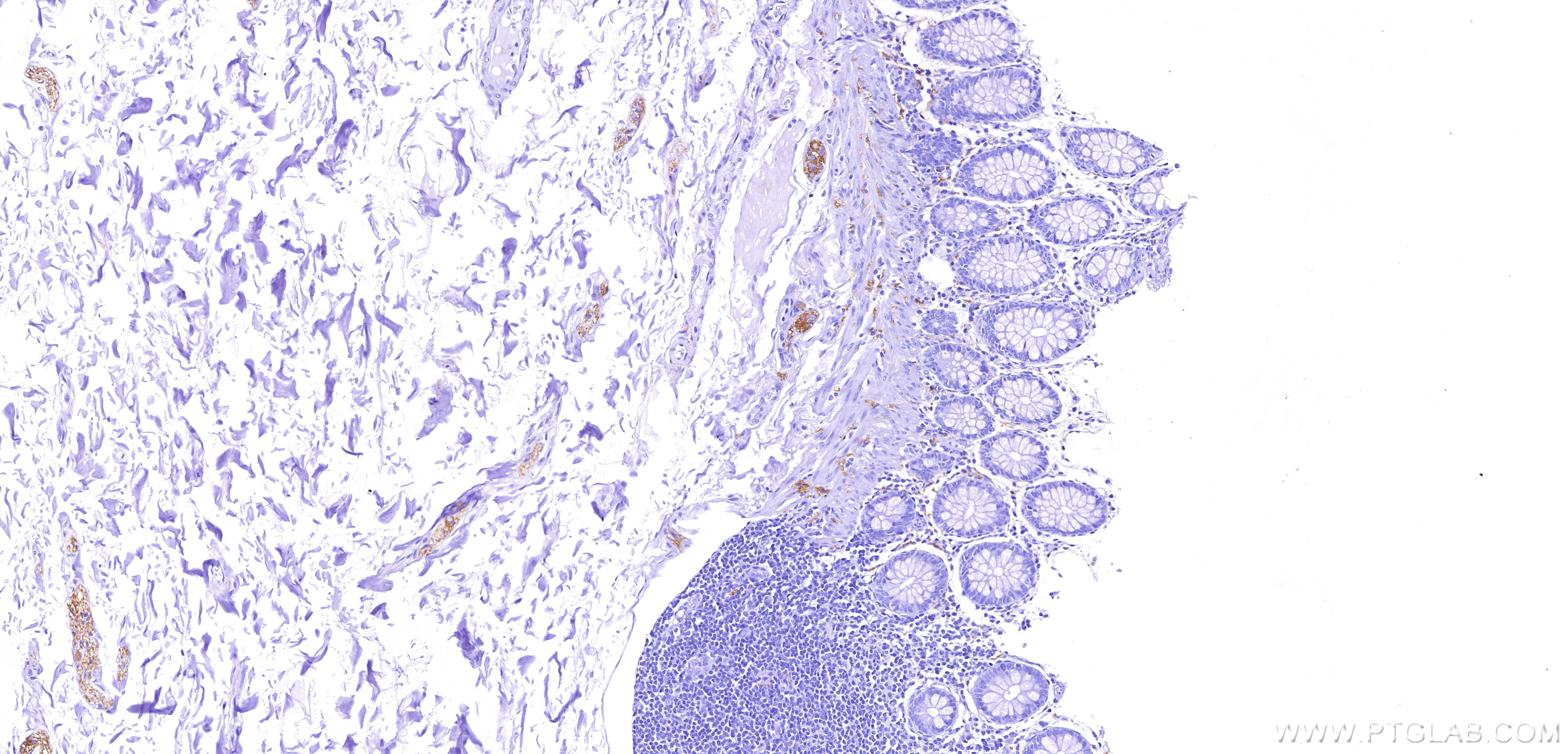 Immunohistochemistry (IHC) staining of human colon tissue using TAU Recombinant monoclonal antibody (82846-5-RR)