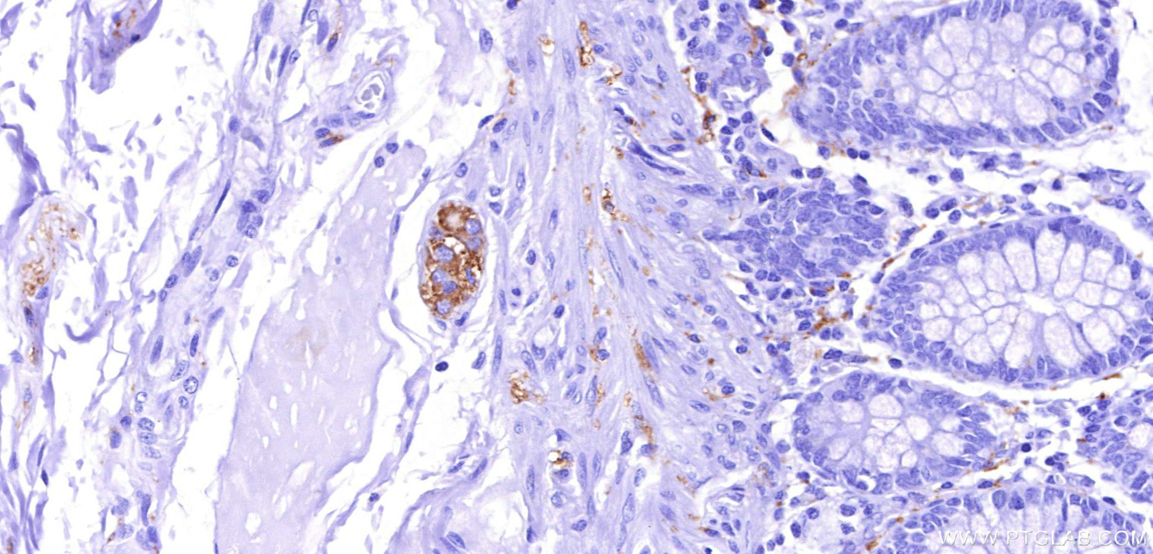 Immunohistochemistry (IHC) staining of human colon tissue using TAU Recombinant monoclonal antibody (82846-5-RR)