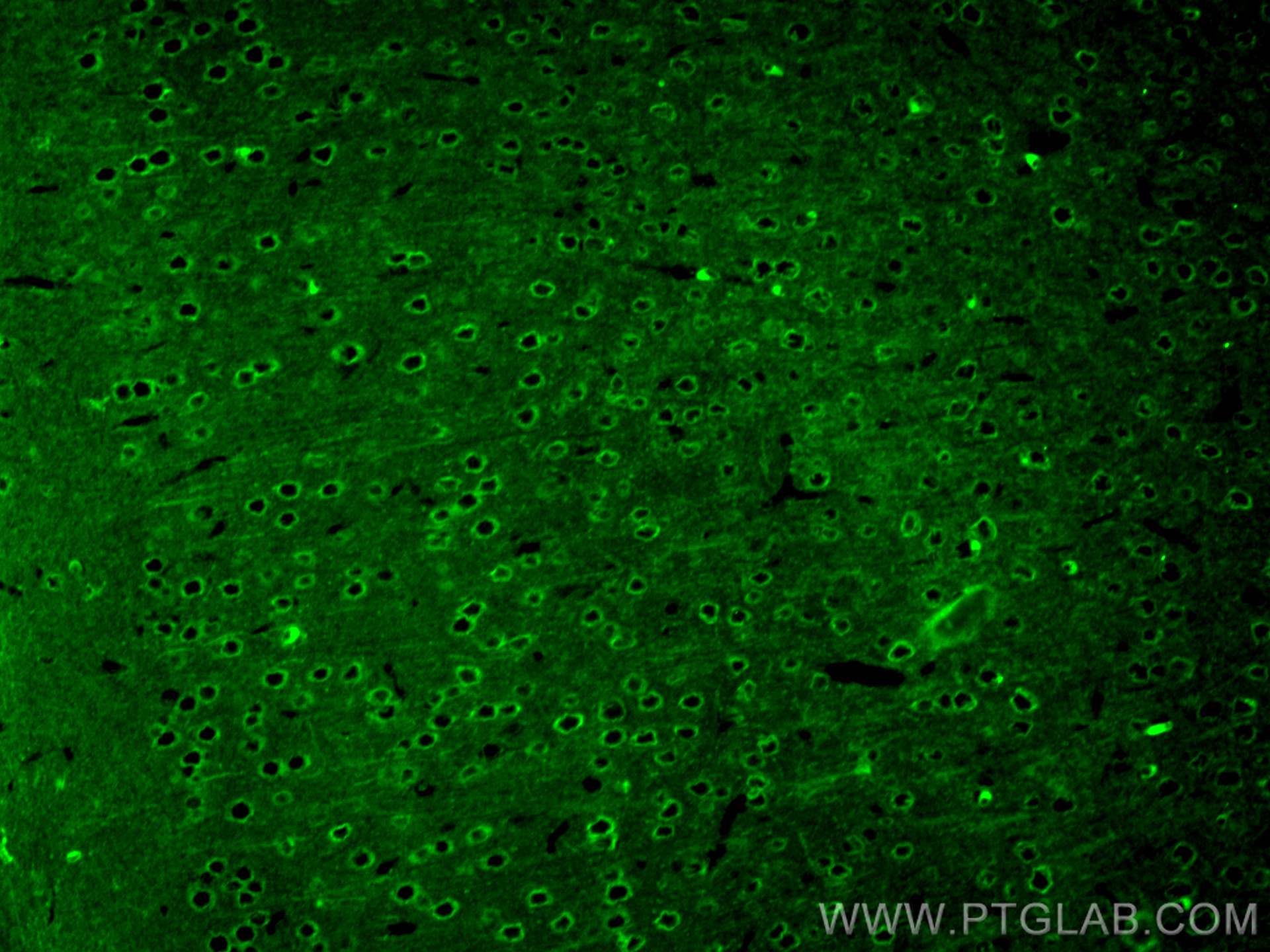 Immunofluorescence (IF) / fluorescent staining of mouse brain tissue using CoraLite® Plus 488-conjugated TAU Polyclonal antib (CL488-10274)