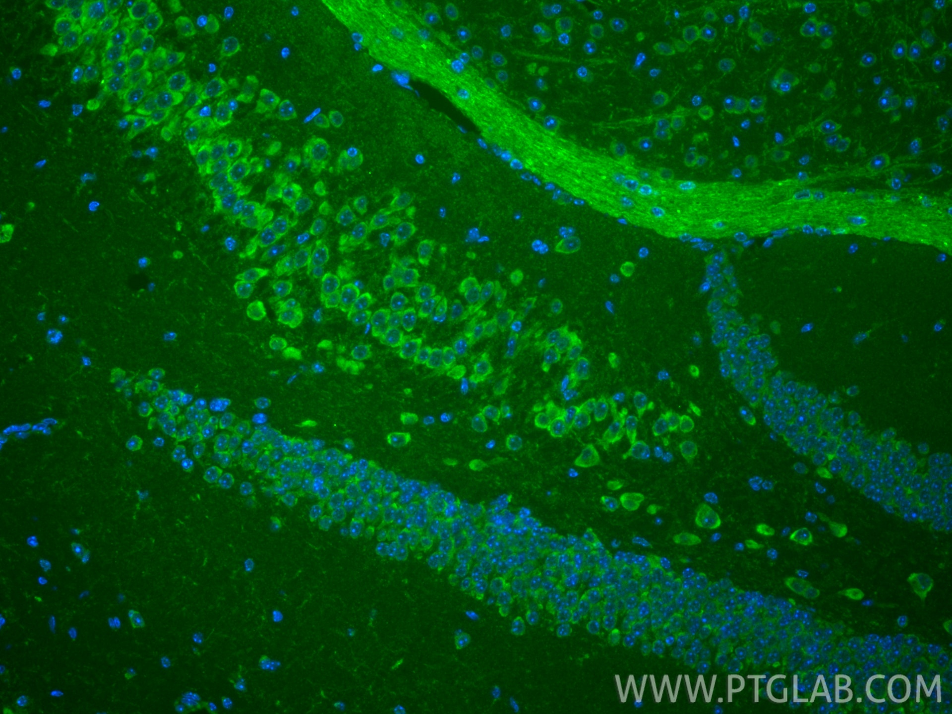 IF Staining of mouse brain using CL488-66499 Immunofluorescence (IF) / fluorescent staining of mouse brain tissue using CoraLite® Plus 488-conjugated TAU Monoclonal antib (CL488-66499)