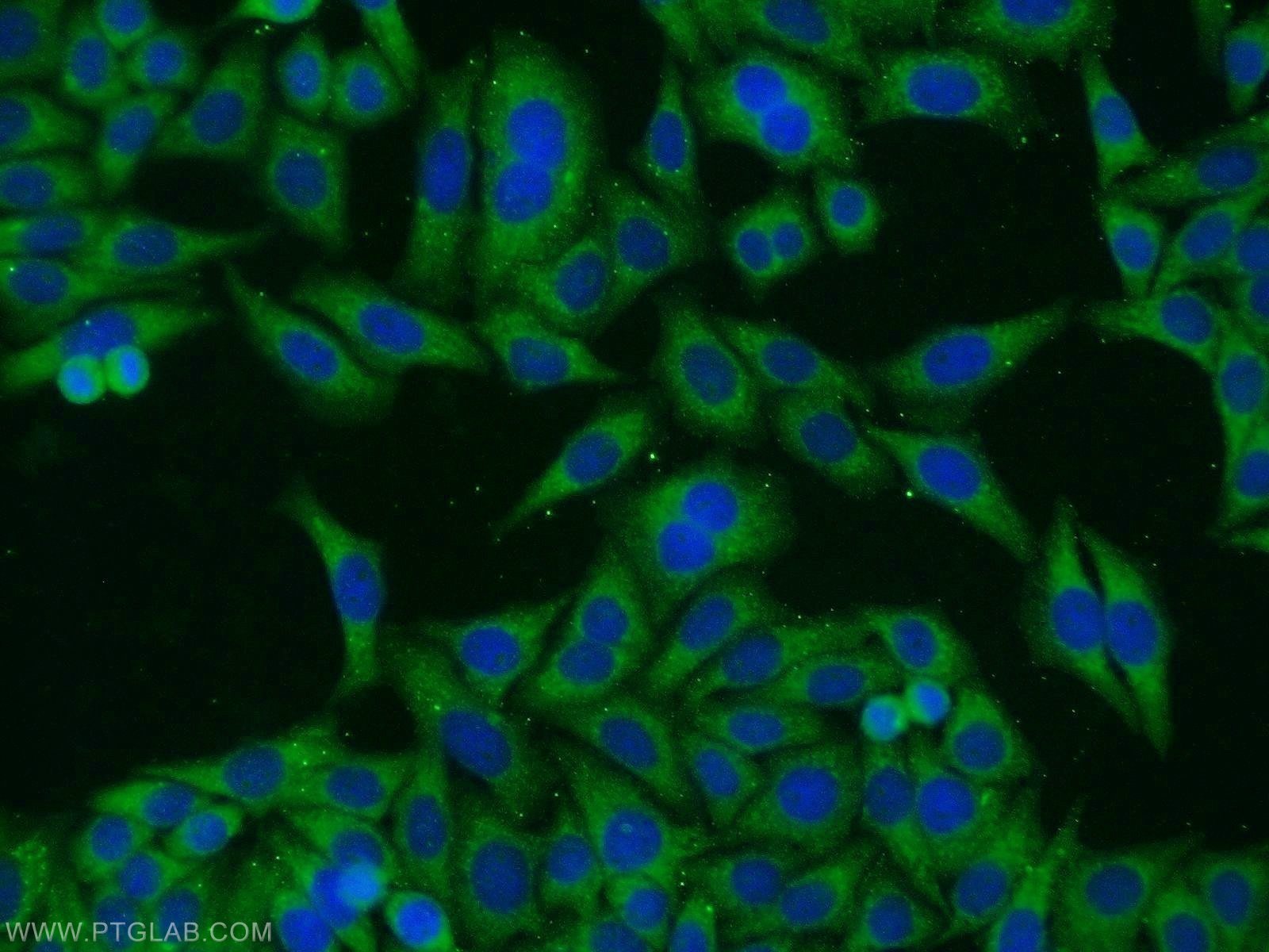 Immunofluorescence (IF) / fluorescent staining of HepG2 cells using TAX1BP1 Polyclonal antibody (14424-1-AP)