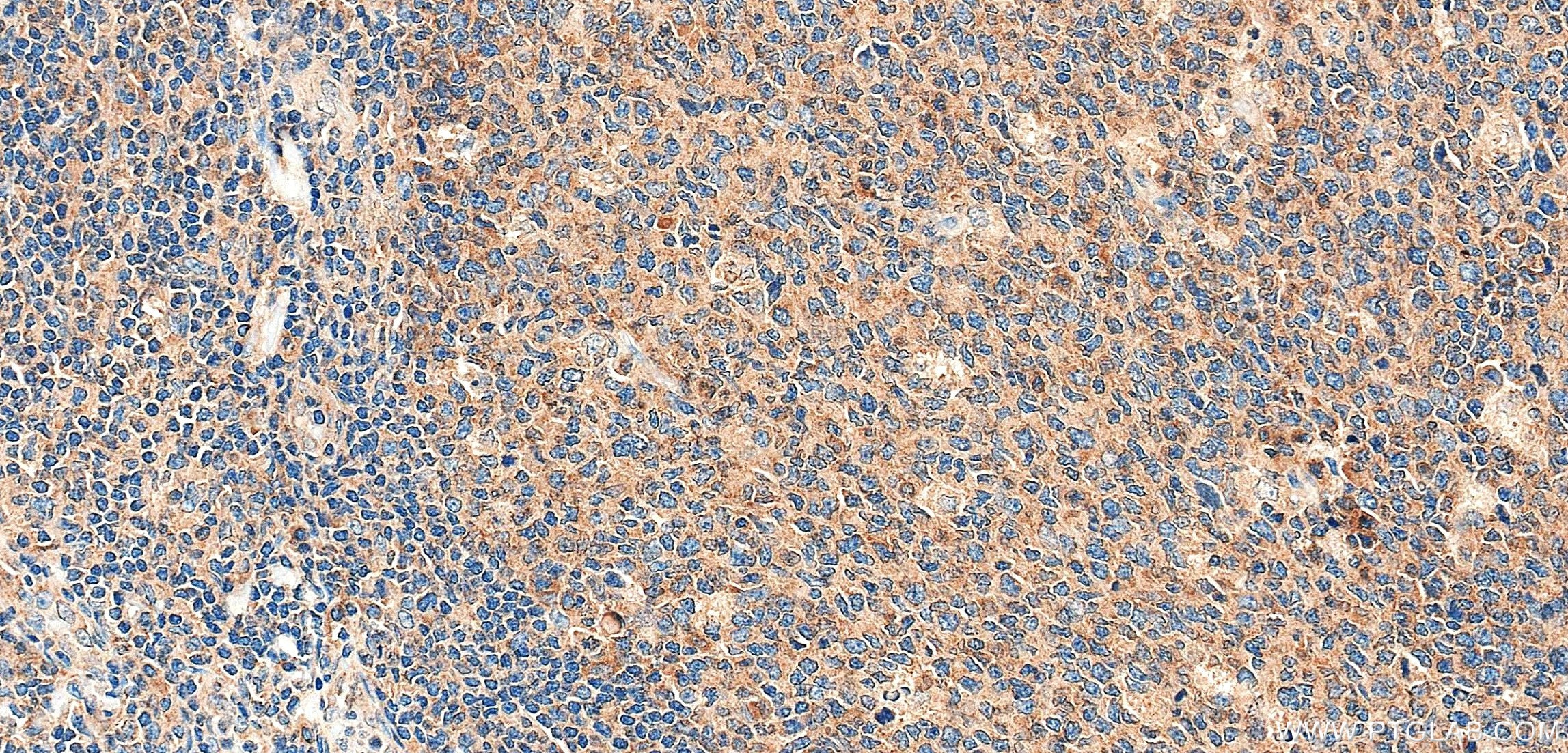 Immunohistochemistry (IHC) staining of human tonsil tissue using TAX1BP1 Recombinant monoclonal antibody (86602-3-RR)