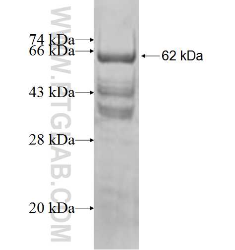 TAX1BP1 fusion protein Ag5789 SDS-PAGE