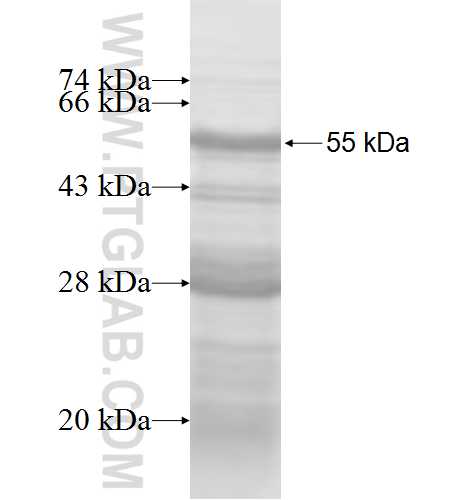 TAX1BP1 fusion protein Ag6279 SDS-PAGE