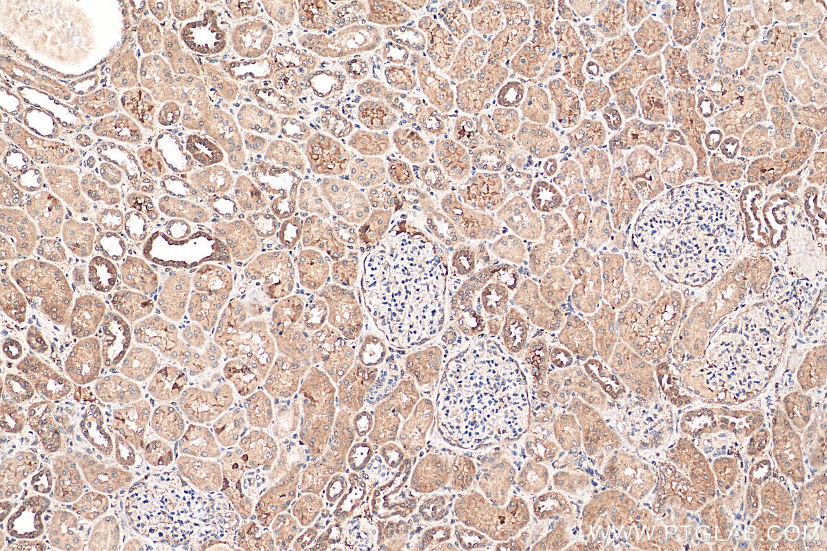 Immunohistochemistry (IHC) staining of human kidney tissue using TAX1BP3 Polyclonal antibody (11692-1-AP)