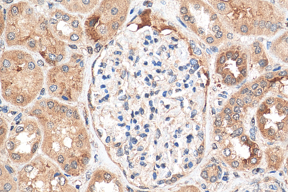 Immunohistochemistry (IHC) staining of human kidney tissue using TAX1BP3 Polyclonal antibody (11692-1-AP)