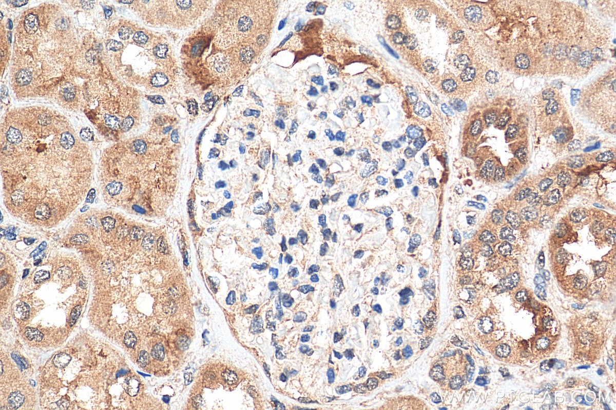 IHC staining of human kidney using 11692-1-AP