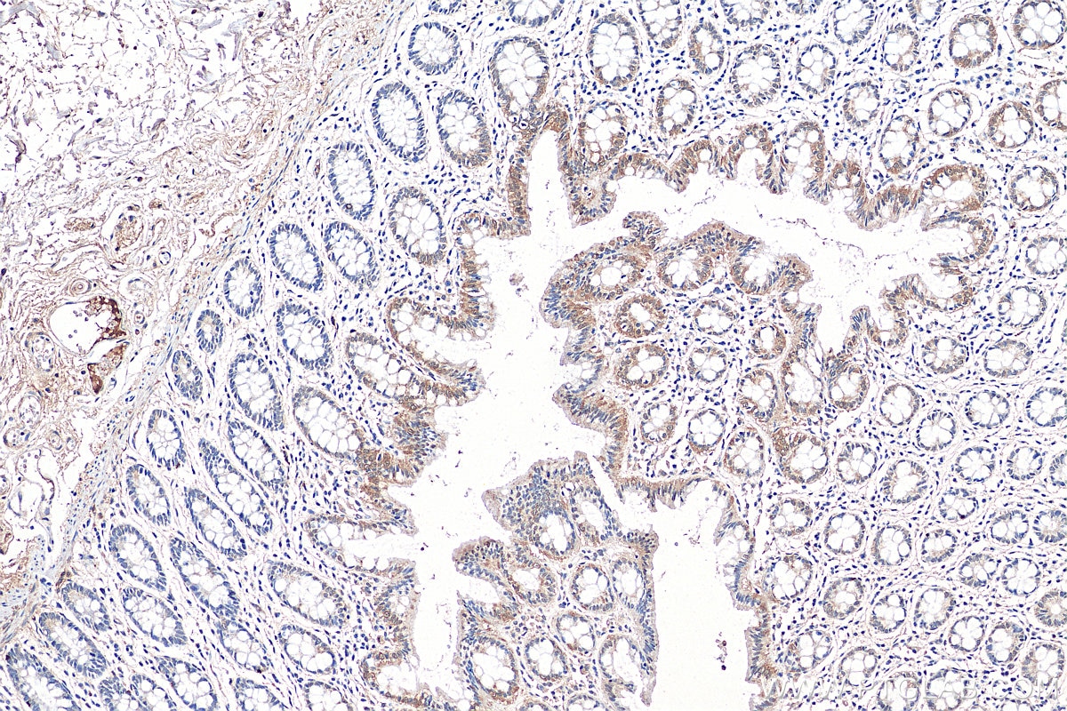 Immunohistochemistry (IHC) staining of human colon tissue using TAX1BP3 Polyclonal antibody (11692-1-AP)