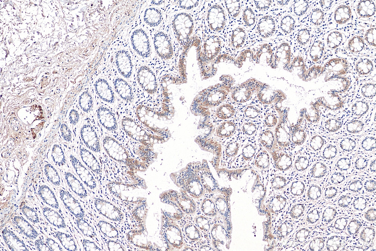 Immunohistochemistry (IHC) staining of human colon tissue using TAX1BP3 Polyclonal antibody (11692-1-AP)
