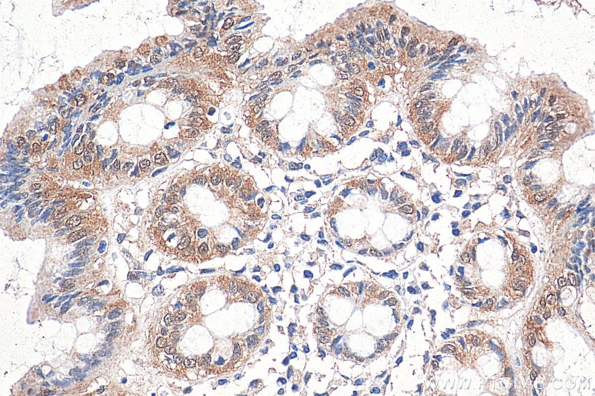 Immunohistochemistry (IHC) staining of human colon tissue using TAX1BP3 Polyclonal antibody (11692-1-AP)
