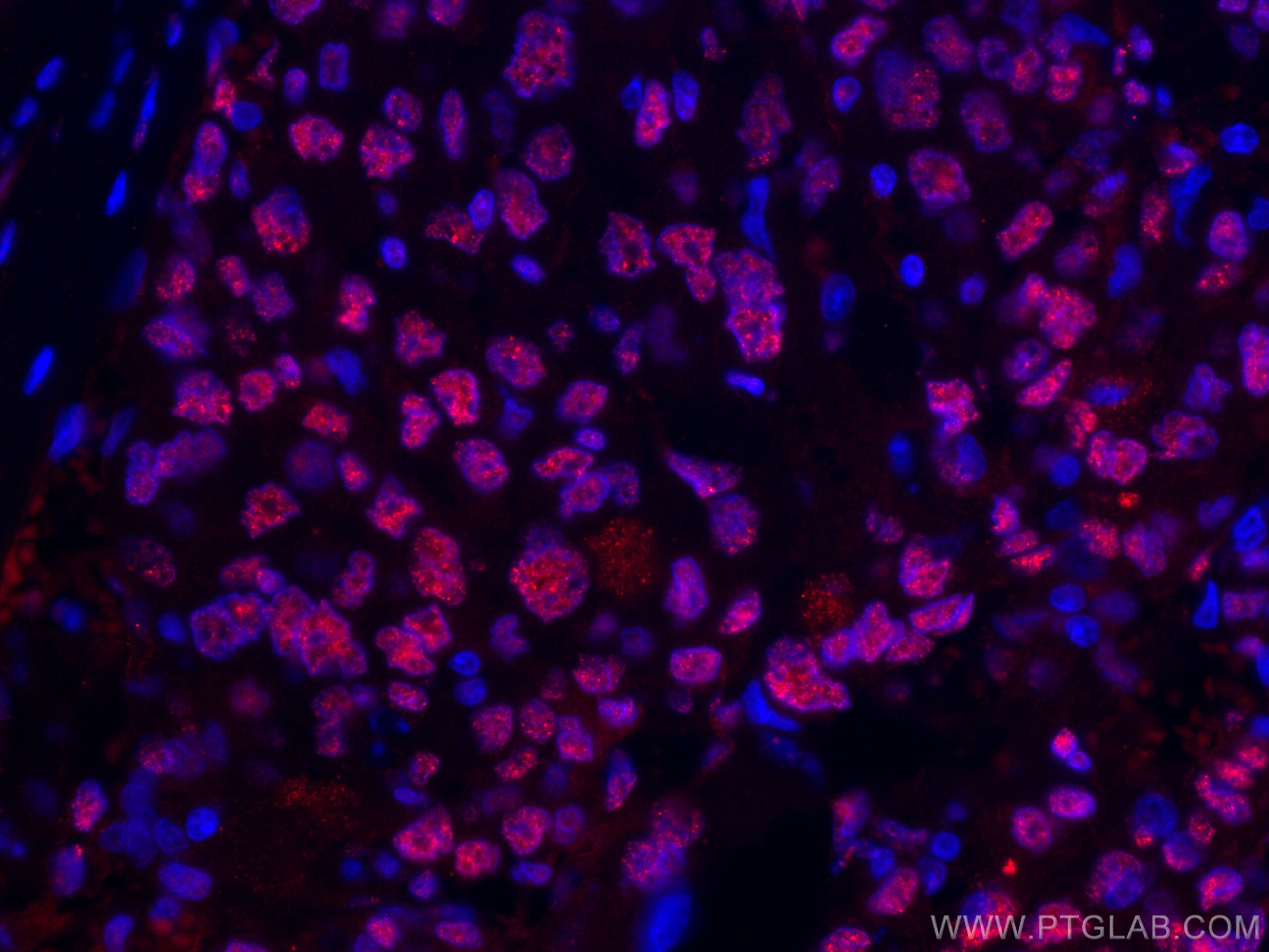 WWTR1 antibody (CL594-66500) | Proteintech