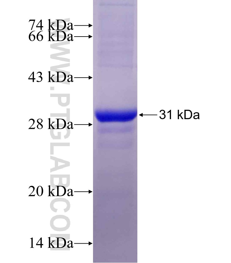 TAZ; tafazzin fusion protein Ag11631 SDS-PAGE