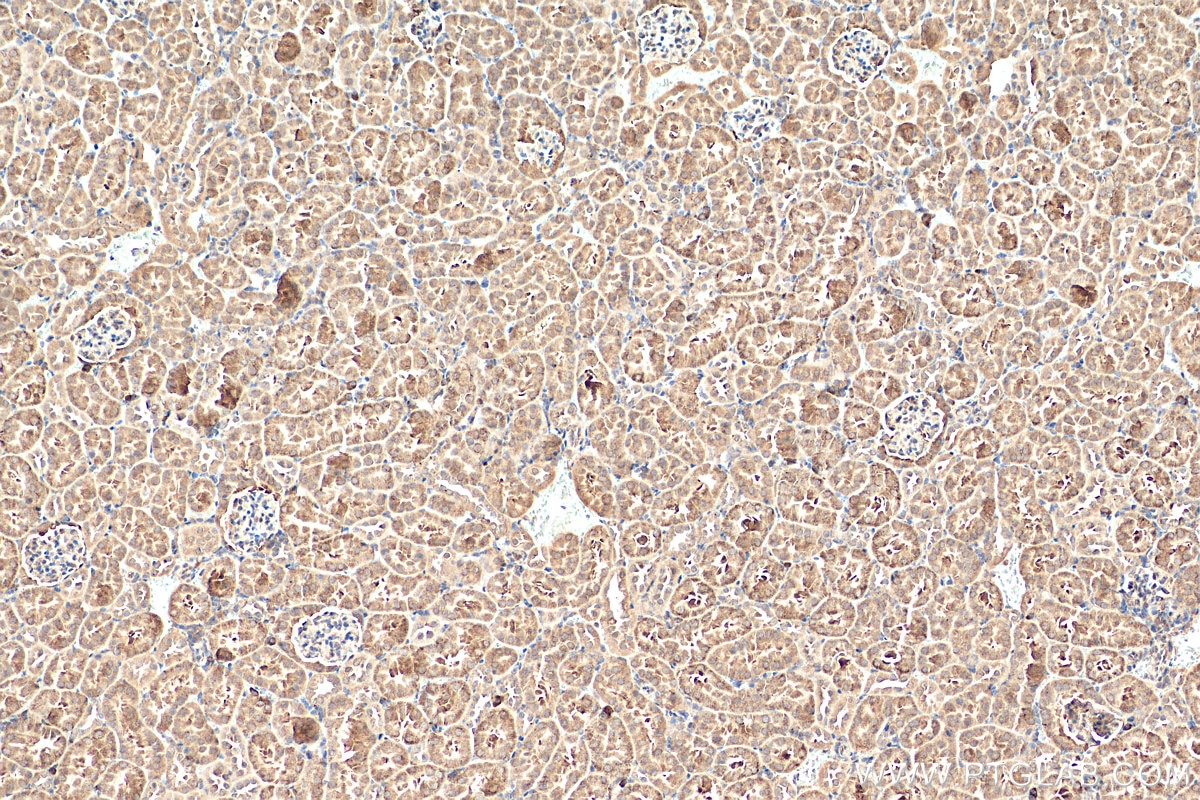 Immunohistochemistry (IHC) staining of mouse kidney tissue using TBC1D1 Polyclonal antibody (22124-1-AP)