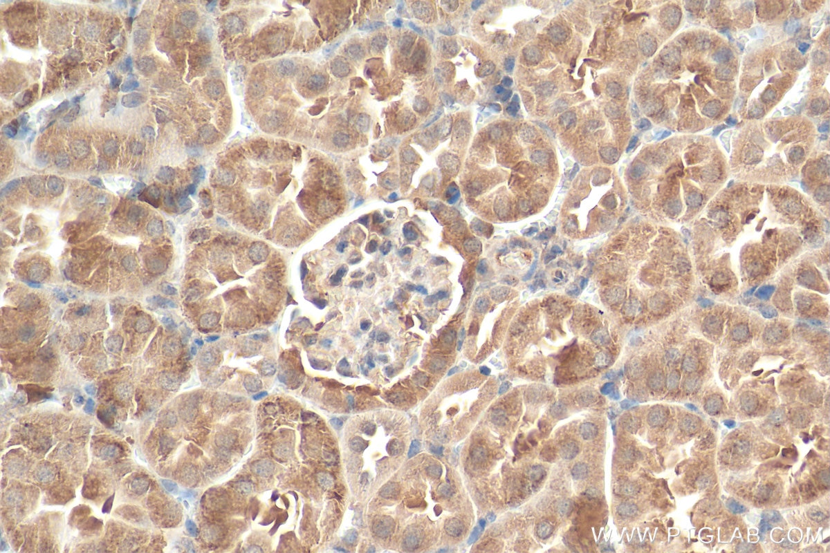 Immunohistochemistry (IHC) staining of mouse kidney tissue using TBC1D1 Polyclonal antibody (22124-1-AP)