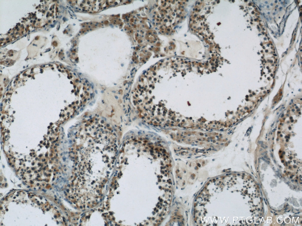 Immunohistochemistry (IHC) staining of human testis tissue using TBC1D1 Polyclonal antibody (22124-1-AP)