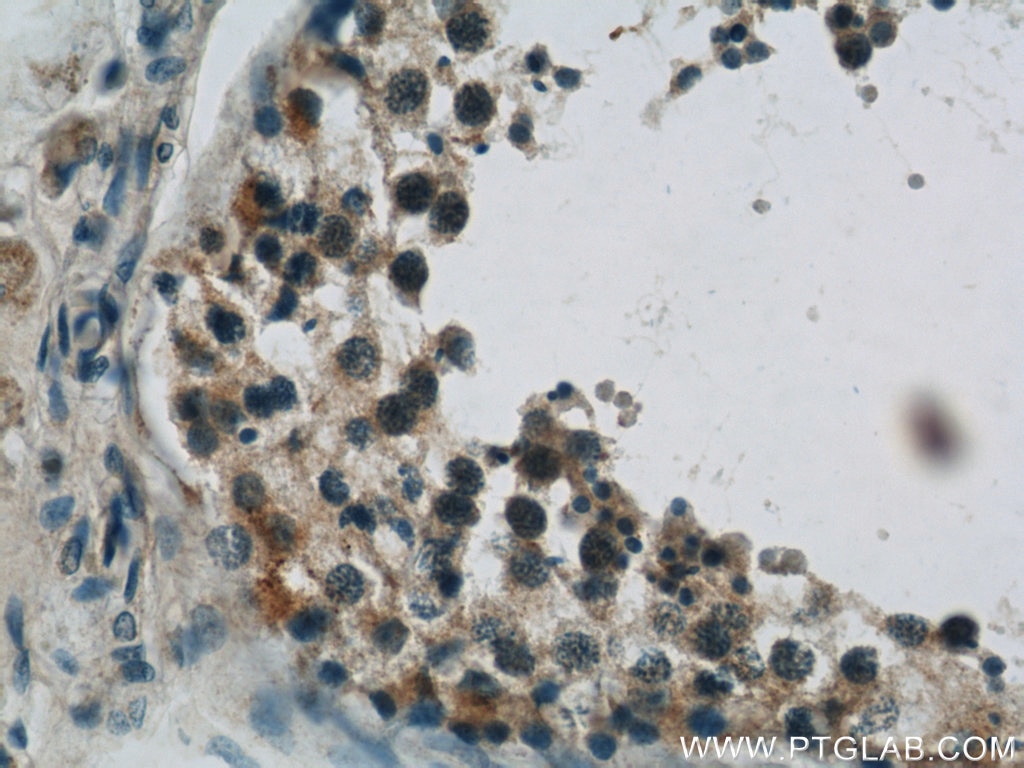 Immunohistochemistry (IHC) staining of human testis tissue using TBC1D1 Polyclonal antibody (22124-1-AP)