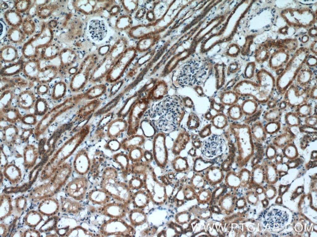 Immunohistochemistry (IHC) staining of human kidney tissue using TBC1D1 Polyclonal antibody (22124-1-AP)