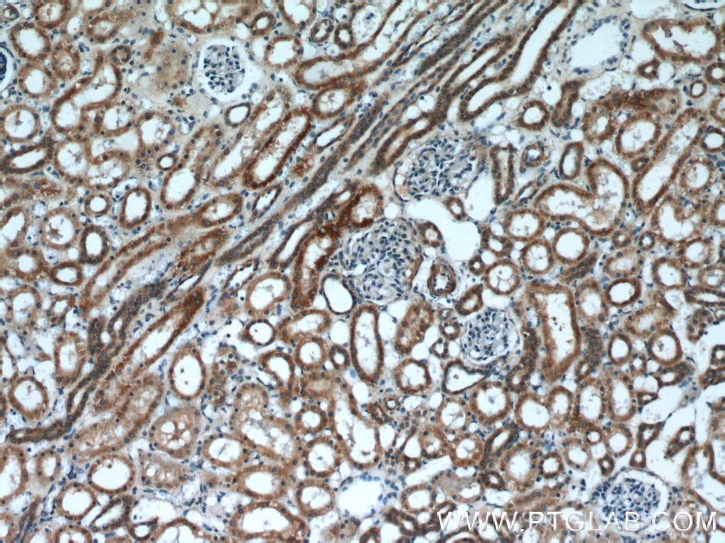 IHC staining of human kidney using 22124-1-AP