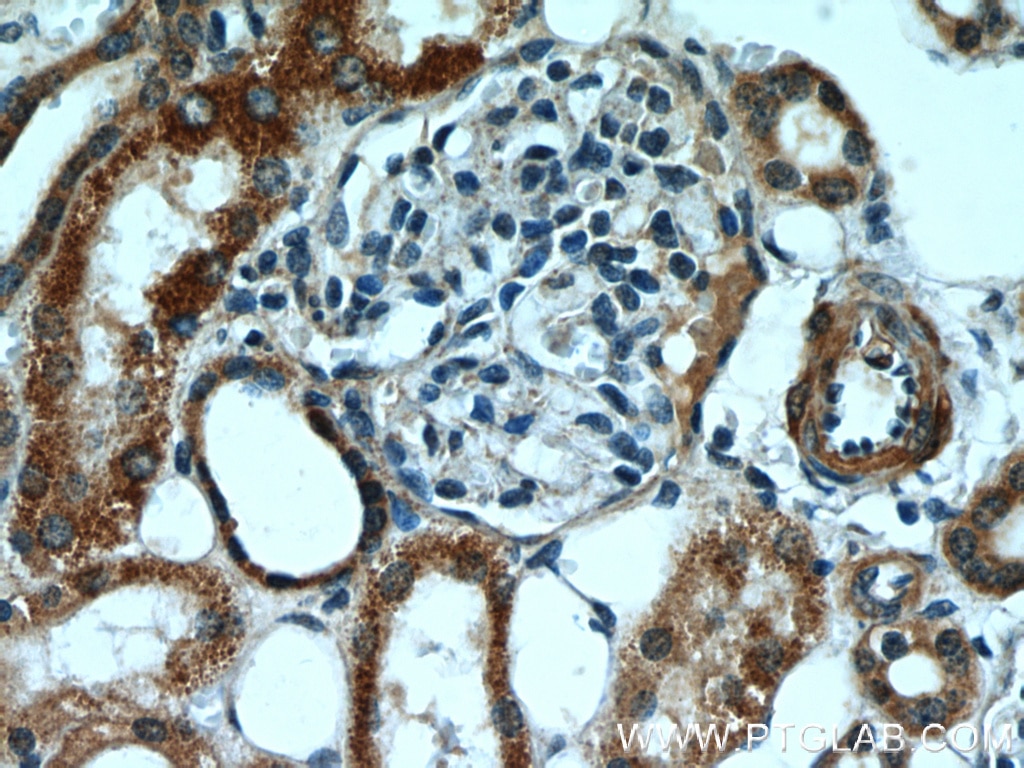 Immunohistochemistry (IHC) staining of human kidney tissue using TBC1D1 Polyclonal antibody (22124-1-AP)