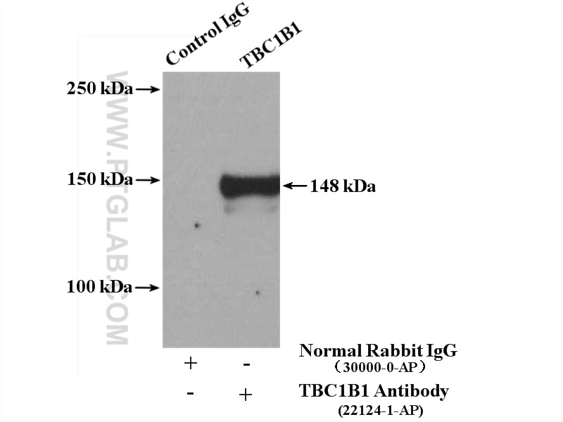 Immunoprecipitation (IP) experiment of Jurkat cells using TBC1D1 Polyclonal antibody (22124-1-AP)