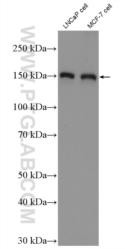 WB analysis of LNCaP using 22124-1-AP