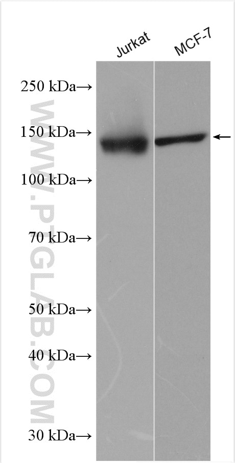 Western Blot (WB) analysis of various lysates using TBC1D1 Polyclonal antibody (22124-1-AP)