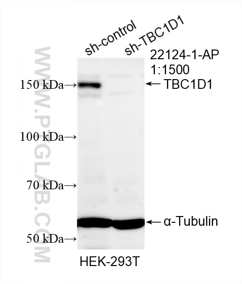 Western Blot (WB) analysis of HEK-293T cells using TBC1D1 Polyclonal antibody (22124-1-AP)