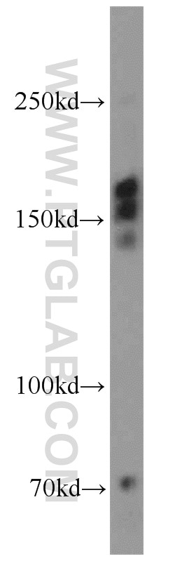Western Blot (WB) analysis of HeLa cells using TBC1D1 Polyclonal antibody (22124-1-AP)