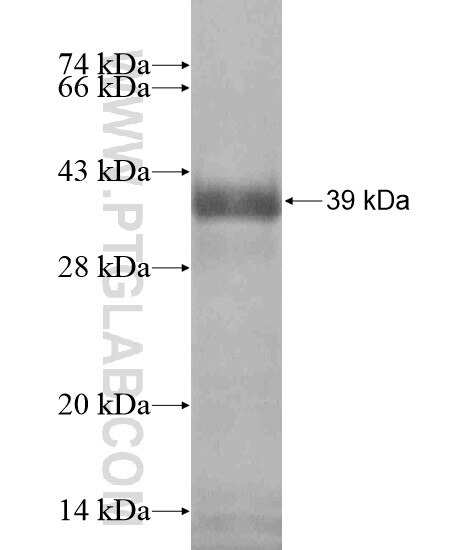 TBC1D10B fusion protein Ag19377 SDS-PAGE