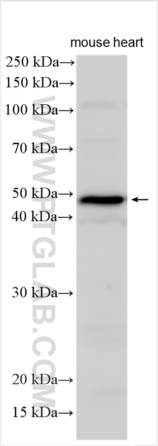 Western Blot (WB) analysis of various lysates using TBC1D13 Polyclonal antibody (24562-1-AP)
