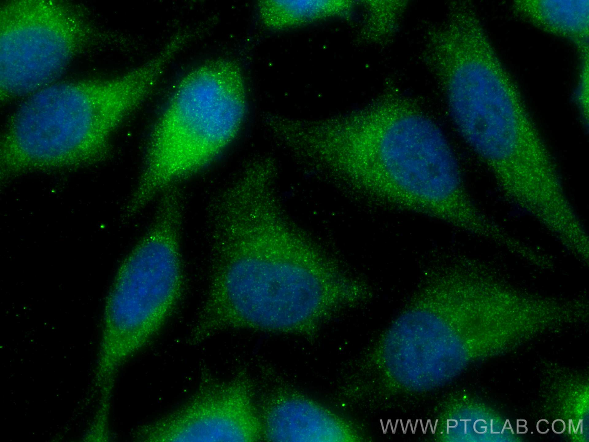 Immunofluorescence (IF) / fluorescent staining of HeLa cells using TBC1D15 Polyclonal antibody (17252-1-AP)