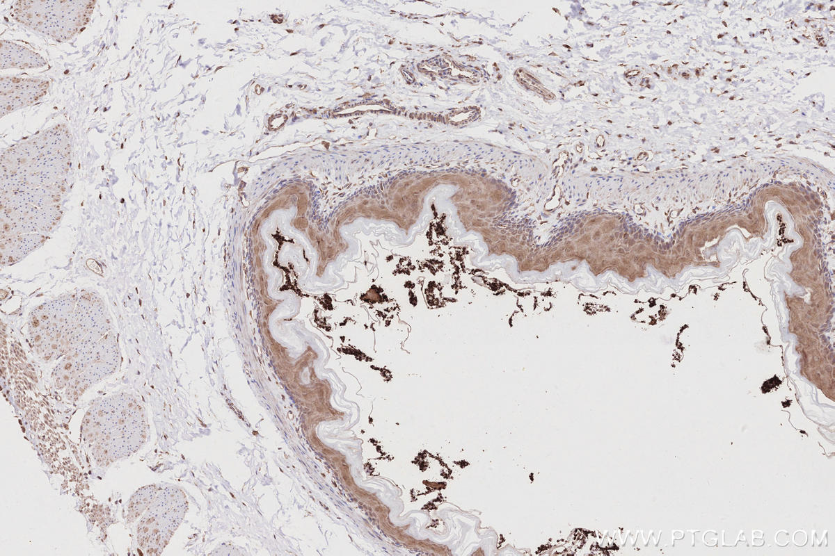 Immunohistochemistry (IHC) staining of rat stomach tissue using TBC1D15 Polyclonal antibody (17252-1-AP)