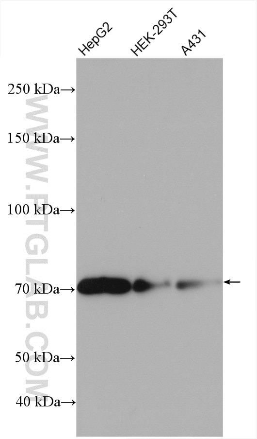 Western Blot (WB) analysis of various lysates using TBC1D15 Polyclonal antibody (17252-1-AP)