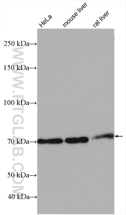Western Blot (WB) analysis of various lysates using TBC1D15 Polyclonal antibody (17252-1-AP)