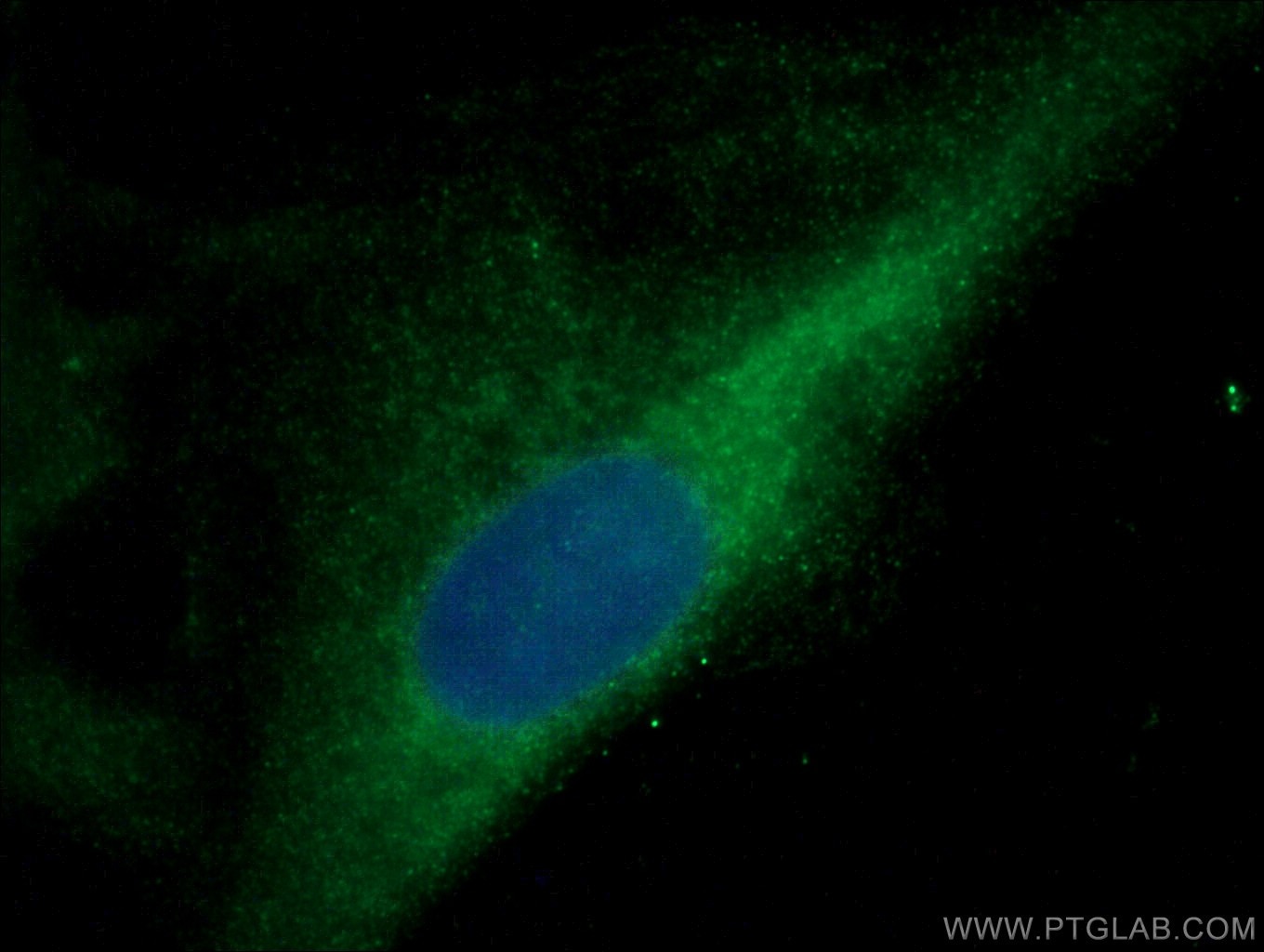 Immunofluorescence (IF) / fluorescent staining of A549 cells using TBC1D17 Polyclonal antibody (20482-1-AP)